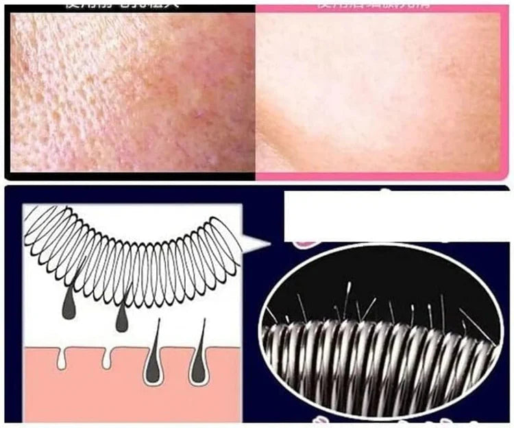 Painless Facial Hair Removal Spring Tool