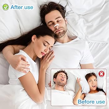 15-Day Nasal Dilator Kit