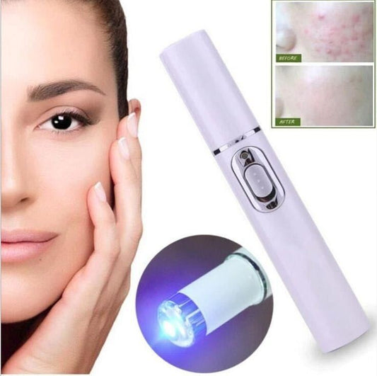 Anti-Acne Light Therapy Pen