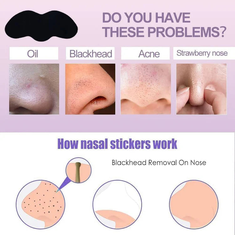 ROSOTENA Nose Pore Strips
