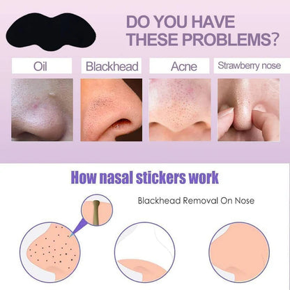 ROSOTENA Nose Pore Strips