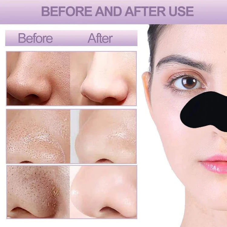 ROSOTENA Nose Pore Strips