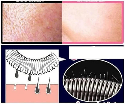 Painless Facial Hair Removal Spring Tool