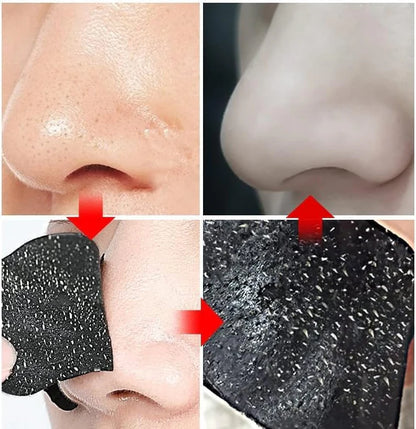 ROSOTENA Nose Pore Strips