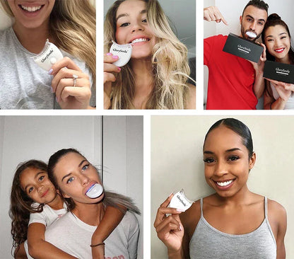 GlorySmile Teeth Whitening kit