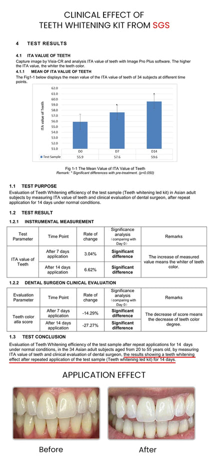 GlorySmile Teeth Whitening kit