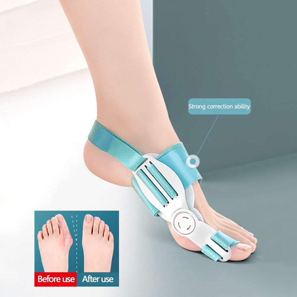 FeetiFix Bunion Aid Splint