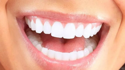 GlorySmile Teeth Whitening kit