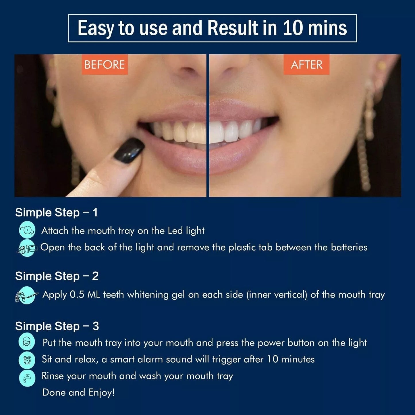 GlorySmile Teeth Whitening kit